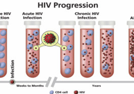Why HIV Can Remain Asymptomatic for Many Years (DETAILS)