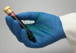 BREAKING: How Long Can HIV Last When It`s Outside The Body Of A Person?