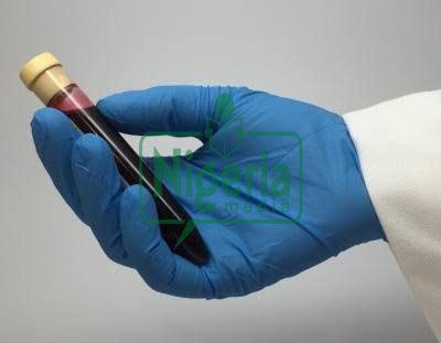 BREAKING: How Long Can HIV Last When It`s Outside The Body Of A Person?