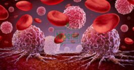 BREAKING NEWS: Blood Cancer Kills Please Avoid Taking These Things In Excess
