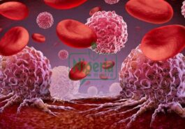 BREAKING NEWS: Blood Cancer Kills Please Avoid Taking These Things In Excess