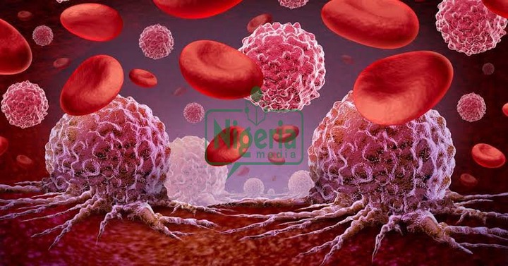 BREAKING NEWS: Blood Cancer Kills Please Avoid Taking These Things In Excess BREAKING NEWS: Blood Cancer Kills Please Avoid Taking These Things In Excess