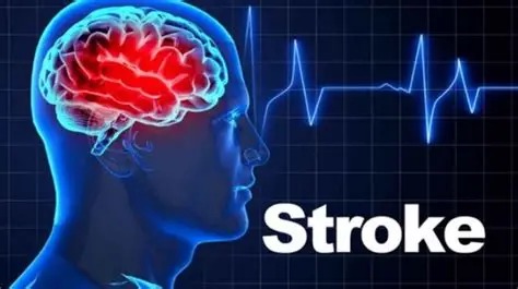 BREAKING NEWS: If You Don’t Want To Suffer Stroke At Old Age, Avoid Excess Intake Of These Three Things BREAKING NEWS: If You Don’t Want To Suffer Stroke At Old Age, Avoid Excess Intake Of These Three Things