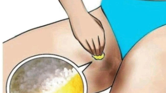 Ladies, If Your Inner Thighs Are Dark, See Easy Ways You Can Lighten Them Ladies, If Your Inner Thighs Are Dark, See Easy Ways You Can Lighten Them