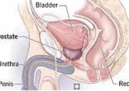 What Men Should Do To Reduce The Risk Of Prostrate Enlargement As They Grow Older