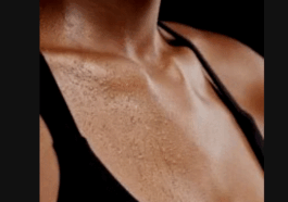 “Why do I sweat so much?” An expert reveals the causes of excessive sweating