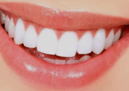 If you want your teeth to shine like pearls then apply just these two things