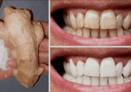 Ten 10 natural methods to whiten your teeth at home