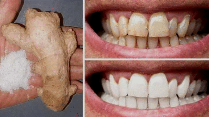 Ten 10 natural methods to whiten your teeth at home