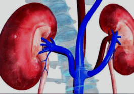 BREAKING: How artificial sweeteners fuel diabetes, damage kidney, say experts