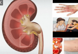 Body Areas That May Hurt When Your Kidneys Are Unhealthy
