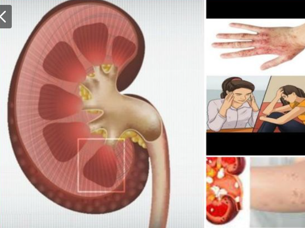 Body Areas That May Hurt When Your Kidneys Are Unhealthy