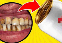 BREAKING: 5 Drinks That Can Rot Your Teeth Over Time