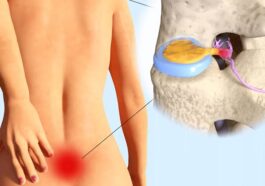 If Your Man Complains Of Waist Pain All The time, Here Are Some Reason’s Behind It