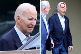 Biden, 82, Seen With Large Scar on Head Following Skin Cancer Surgery (PHOTOS)