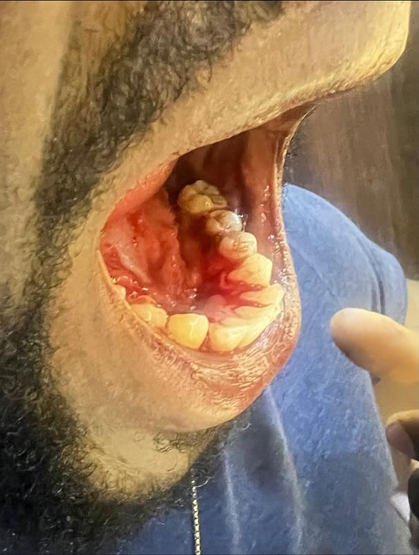 Actor Taye Arimoro drags Peggy Ovire to court demands N100m over alleged assault on movie set