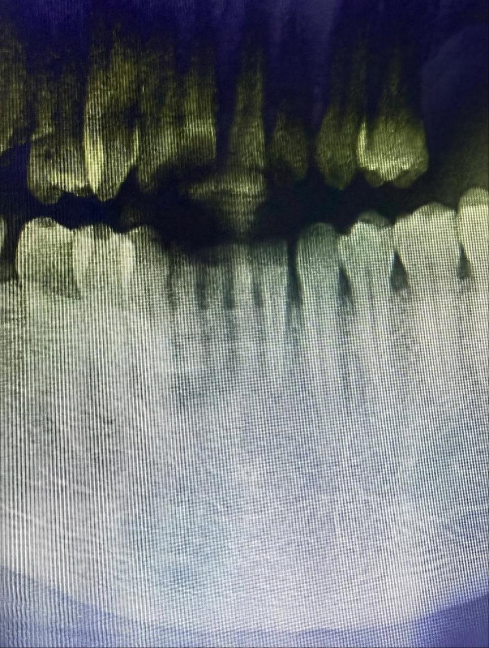 Actor Taye Arimoro drags Peggy Ovire to court demands N100m over alleged assault on movie set