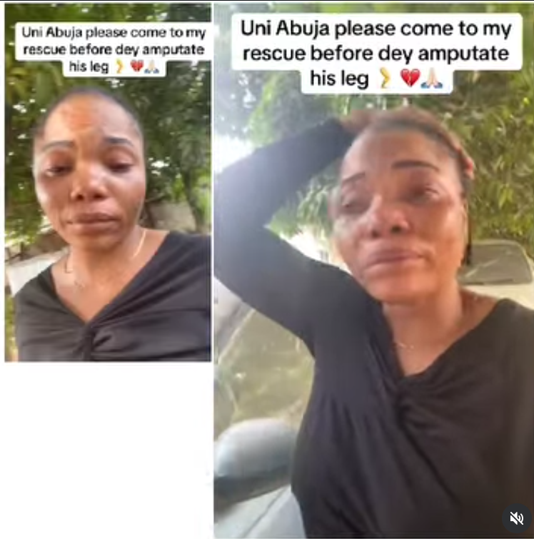 Lady cries out after her brother was knocked down by keke on his way to early morning test at UniAbuja, faces possible leg amputation